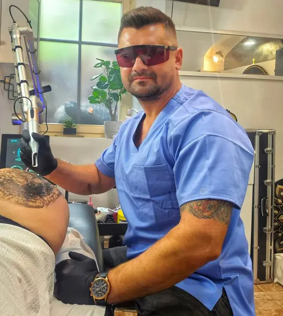 Andrei Neagu lucrând cu laserul la o ședință de îndepărtare