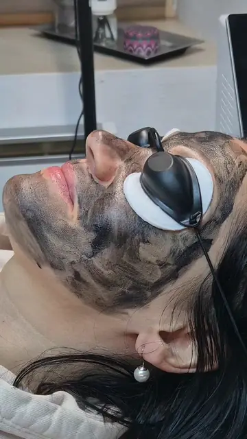 Peeling cu carbon